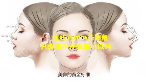 埋线九mm开眼角 只埋线不开眼角可以吗